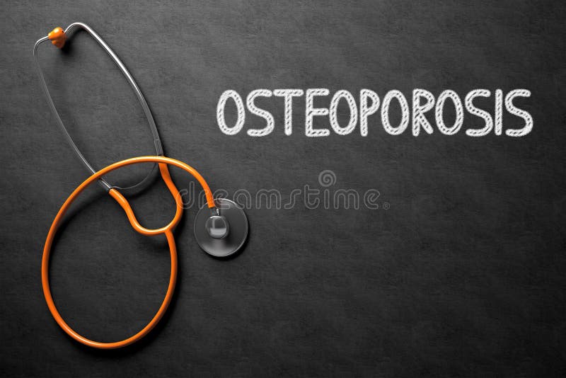 Osteoporosis manuscrita en la pizarra ilustración 3D stock de ilustración Osteoporosis manuscrita en la pizarra ilustración 3D stock de ilustración