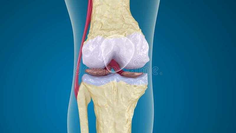 Ostéoporose de l'articulation du genou illustration libre de droits