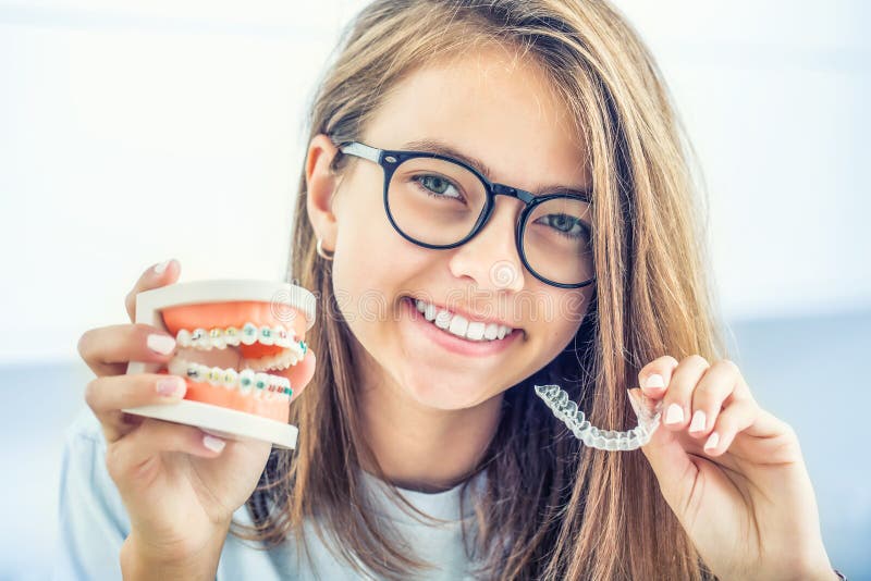 Osynliga tandklamrar eller silikontränare i händerna på en ung leende flicka Ortodontiskt koncept - Invisalign arkivbilder