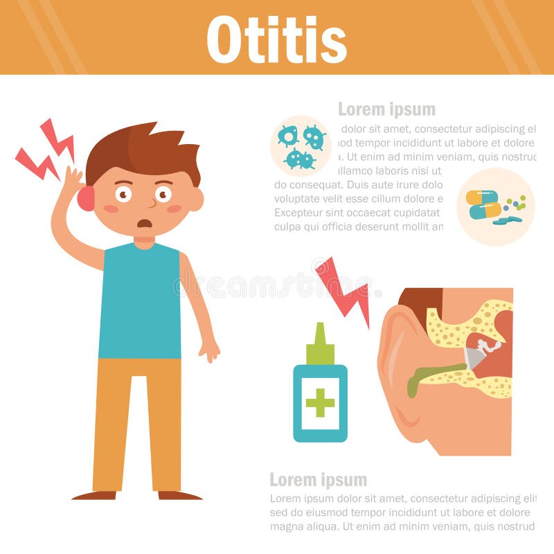 Otitis Διανυσματική τέχνη σε ένα άσπρο υπόβαθρο απεικόνιση αποθεμάτων Otitis Διανυσματική τέχνη σε ένα άσπρο υπόβαθρο απεικόνιση αποθεμάτων