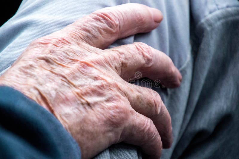 A close up of an elderly person's hand resting on their leg. A close up of an elderly person's hand resting on their leg