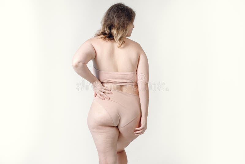 An Overweight Plus-size Woman with Stretch Marks on Her Skin, Standing in  White Underwear. Women& X27;s Thick Thighs Stock Image - Image of obese,  female: 263438095