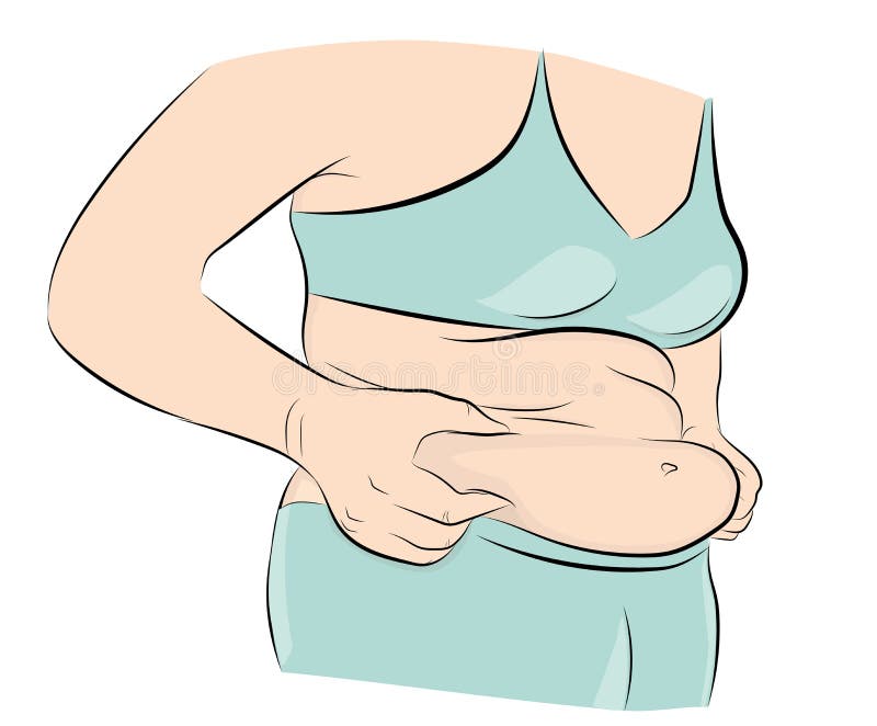 Overweight. the problem of obesity. losing weight. vector illustration. stock illustration Overweight. the problem of obesity. losing weight. vector illustration. stock illustration