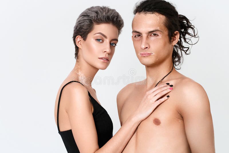 Paarvrouw en man het portret van de huidproblemen van Vitiligo Ongebruikelijke pe stock afbeelding Paarvrouw en man het portret van de huidproblemen van Vitiligo Ongebruikelijke pe stock afbeelding