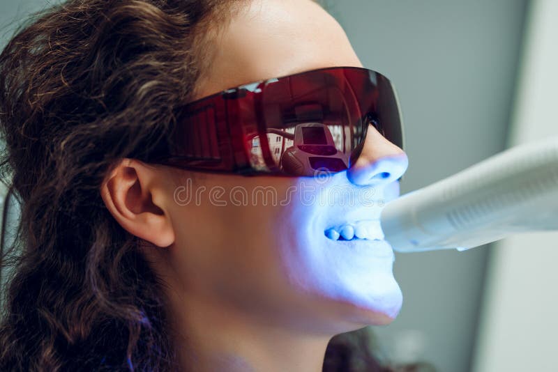 Paciente da menina na cl?nica dental Dentes que claream a l?mpada UV com composi??o do photopolymer Vista lateral imagens de stock royalty free Paciente da menina na cl?nica dental Dentes que claream a l?mpada UV com composi??o do photopolymer Vista lateral imagens de stock royalty free