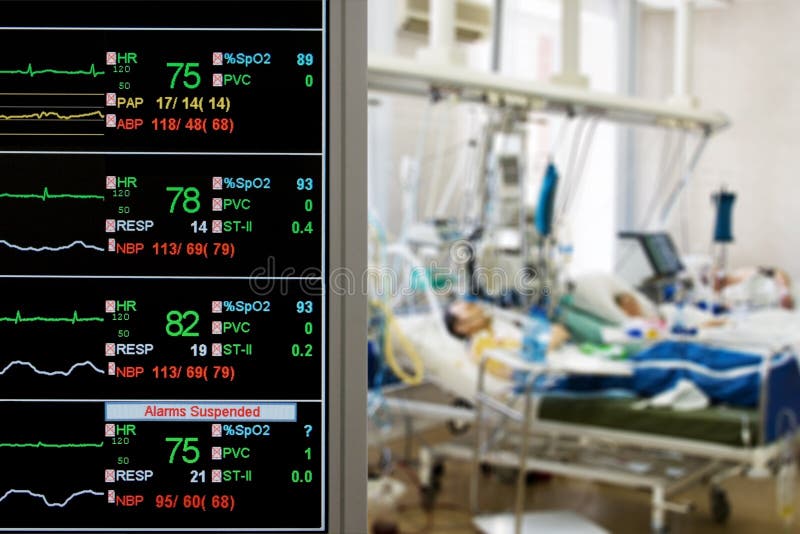 Pacientes que monitoram em ICU Pacientes que monitoram em ICU