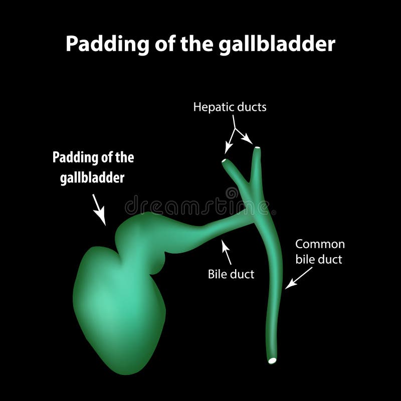 Padding of the Gallbladder. Pathology of the Gallbladder. Cholecystitis