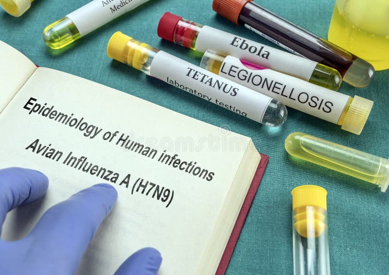 Pagina medica del libro di epidemiologia delle infezioni umane con influenza aviaria Un H7N9
