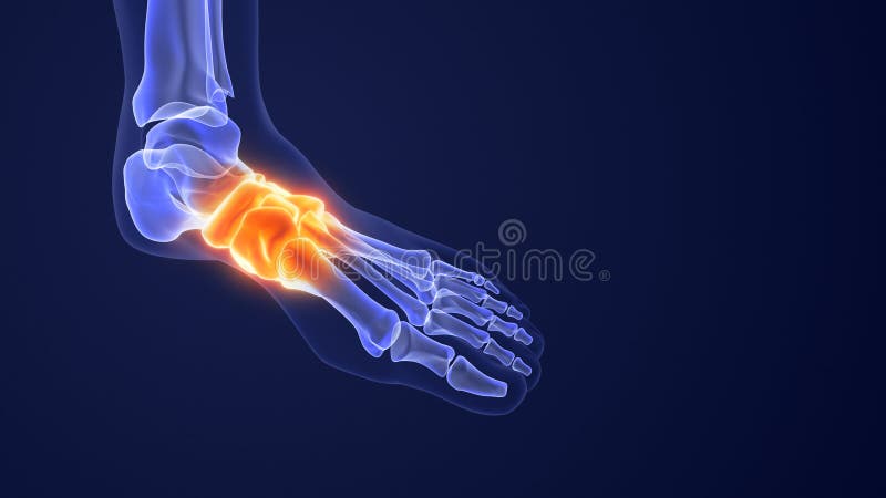 Pain from Aching Feet and Fallen Arches Stock Illustration ...