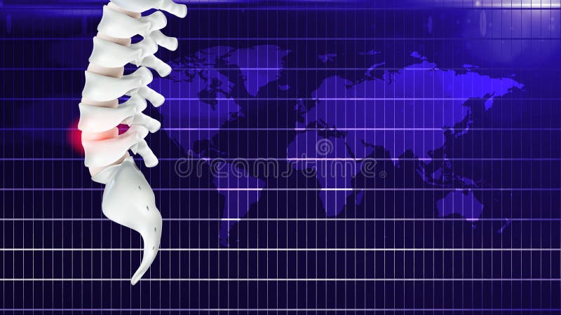 Pain in the bone or office syndrome, or caused by prolonged work stock illustration Pain in the bone or office syndrome, or caused by prolonged work stock illustration
