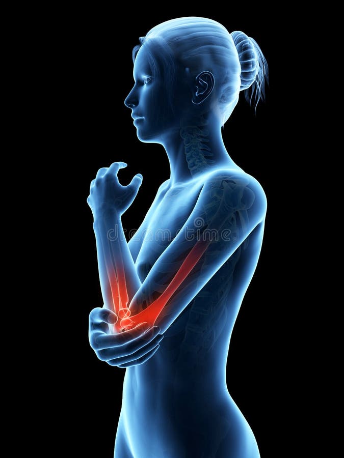 Pain in the elbow joint stock illustration