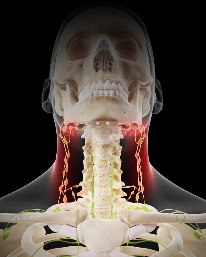 Painful Lymphatic Nodes Stock Illustration Illustration Of Lymph