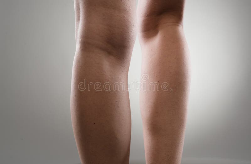 Painful woman's legs royalty free stock photo Painful woman's legs royalty free stock photo