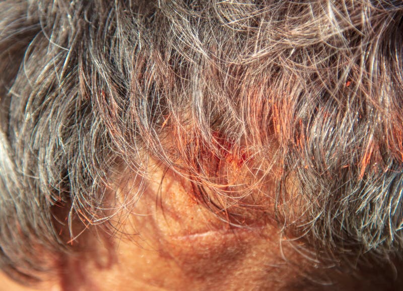 The Paint on the Hair of a Man Stock Image Image of stain