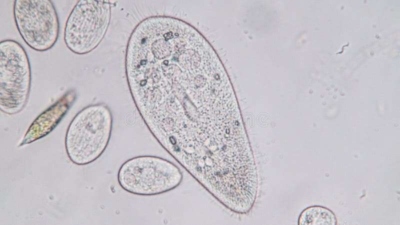 ciliates under microscope