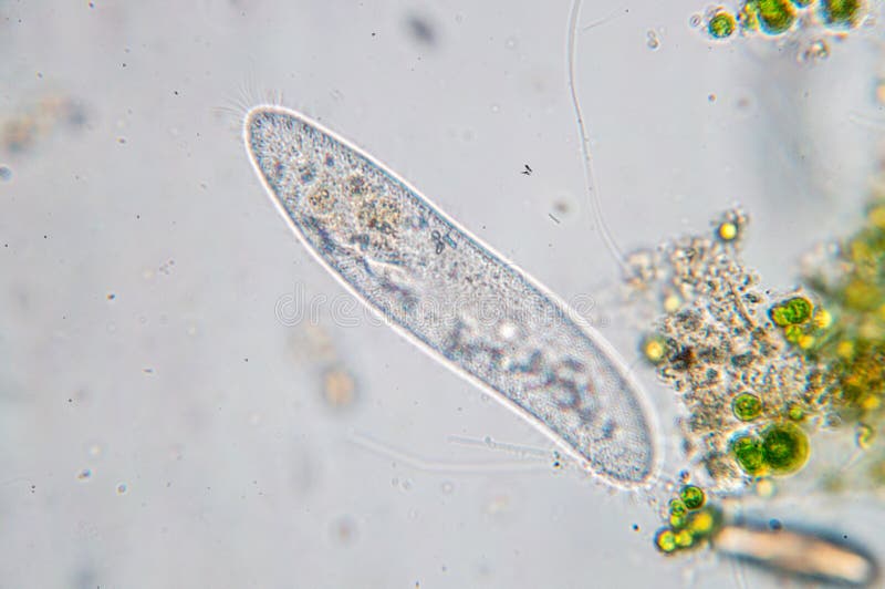 Как выглядит инфузория туфелька фото под микроскопом Paramecium stock image. Image of microbiology, laboratory - 81526891