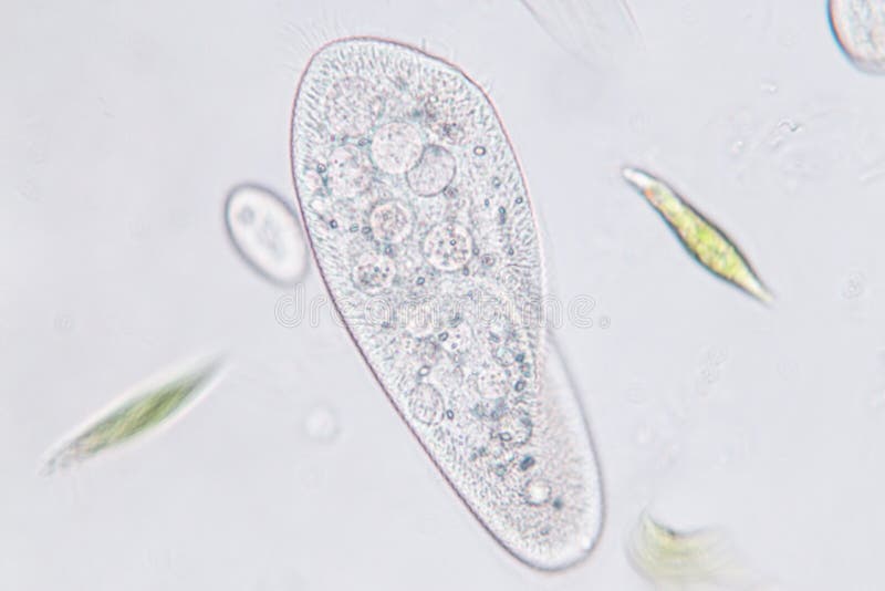 ciliates under microscope