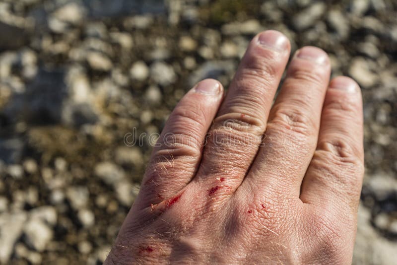 Parecchio piccola ferita sulla sua mano fotografia stock libera da diritti Parecchio piccola ferita sulla sua mano fotografia stock libera da diritti