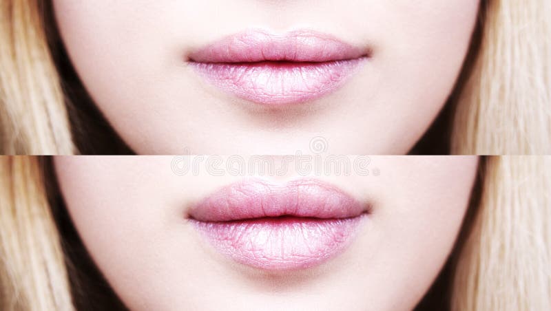 Part of face, young woman close up. plump lips after filler injection.