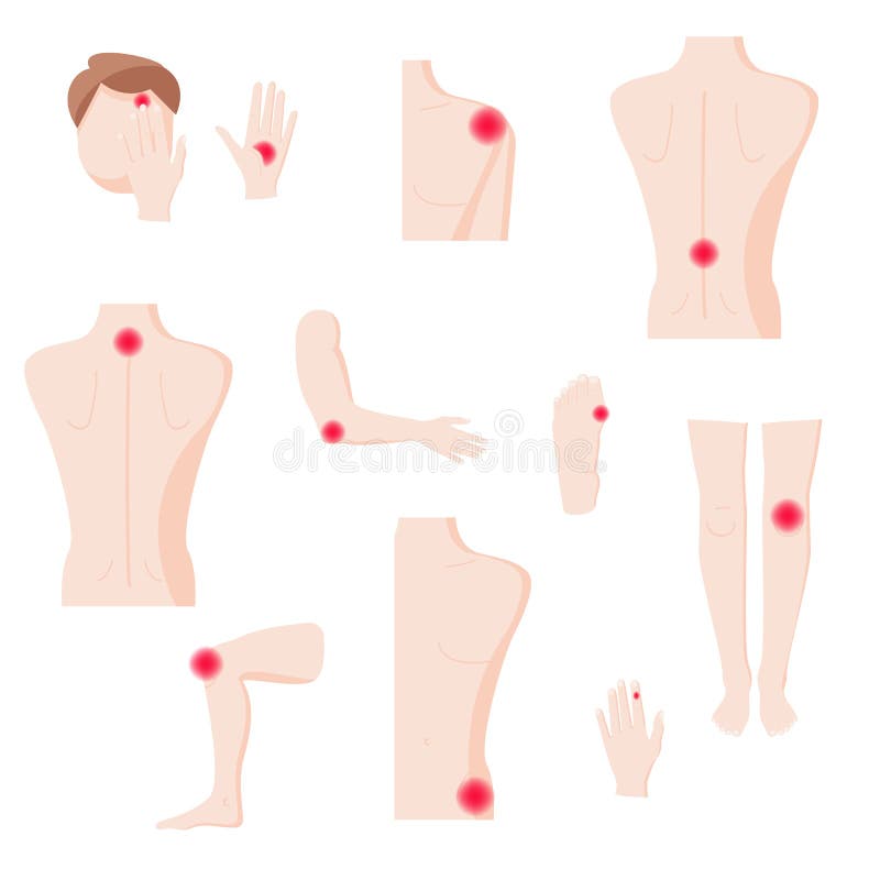 Partes do corpo humanas com zonas da dor, ilustração isolada lisa do vetor ilustração royalty free Partes do corpo humanas com zonas da dor, ilustração isolada lisa do vetor ilustração royalty free