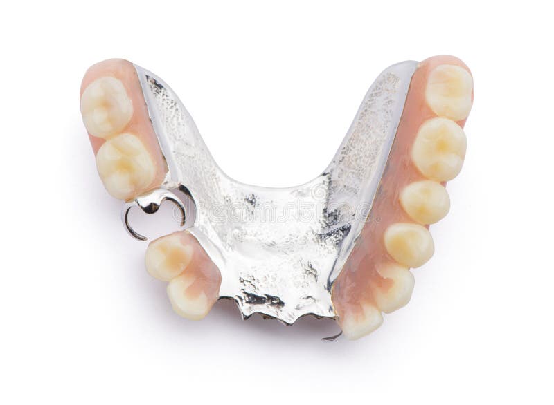 Removable Partial Denture For Upper Teeth Isolated On White Background