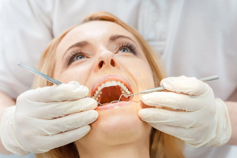 Partial view of blonde woman at dental check up stock image Partial view of blonde woman at dental check up stock image