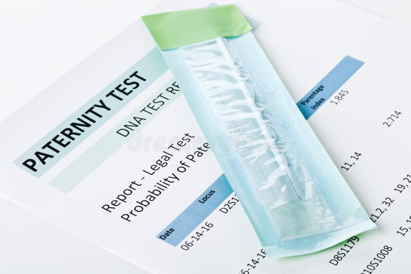 Buccal swab on paternity DNA test result chart form. Buccal swab on paternity DNA test result chart form