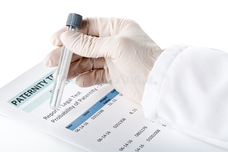 Doctor holding buccal swab in test tube on paternity DNA test result chart form. Doctor holding buccal swab in test tube on paternity DNA test result chart form