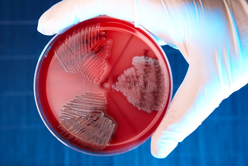 Hand in glove holding Petri plate with bacteria Steptococcus Phaemolifticus G, Streptococcus Agalactiae, Streptococcus Phaemolifticus. Hand in glove holding Petri plate with bacteria Steptococcus Phaemolifticus G, Streptococcus Agalactiae, Streptococcus Phaemolifticus