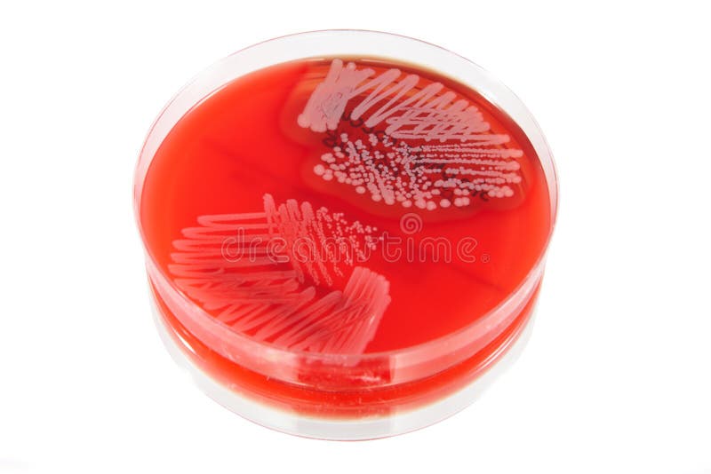 Petri plate with bacteria Staphylococcus Aureus, Moraxella Catarrhalis isolated over white background. Petri plate with bacteria Staphylococcus Aureus, Moraxella Catarrhalis isolated over white background