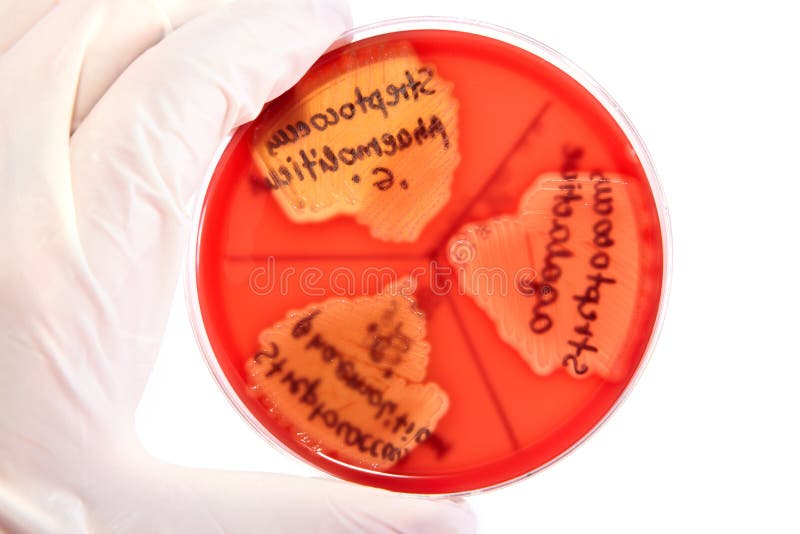 Hand in glove holding Petri plate with bacteria Steptococcus Phaemolifticus G, Streptococcus Agalactiae, Streptococcus Phaemolifticus. Species are responsible for meningitis, pneumonia, endocarditis, erysipelas and necrotizing fasciitis. Part of the normal flora of the mouth, skin, intestine, and upper respiratory tract of humans. Hand in glove holding Petri plate with bacteria Steptococcus Phaemolifticus G, Streptococcus Agalactiae, Streptococcus Phaemolifticus. Species are responsible for meningitis, pneumonia, endocarditis, erysipelas and necrotizing fasciitis. Part of the normal flora of the mouth, skin, intestine, and upper respiratory tract of humans.