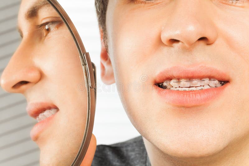 Patient with Dental Braces in Dentist Office Stock Image Image of