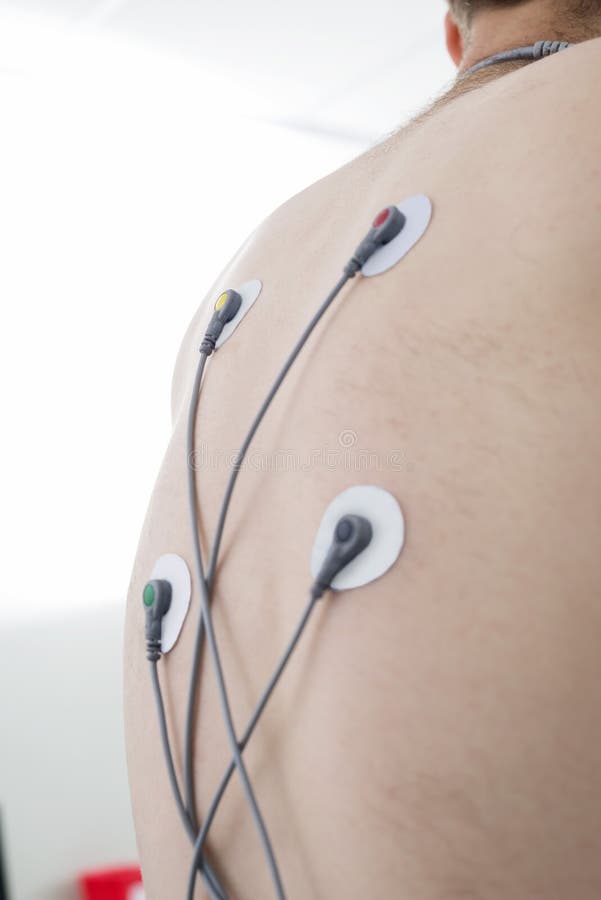 Patient with Electrodes Attached To Body Being Examined by Docto Stock