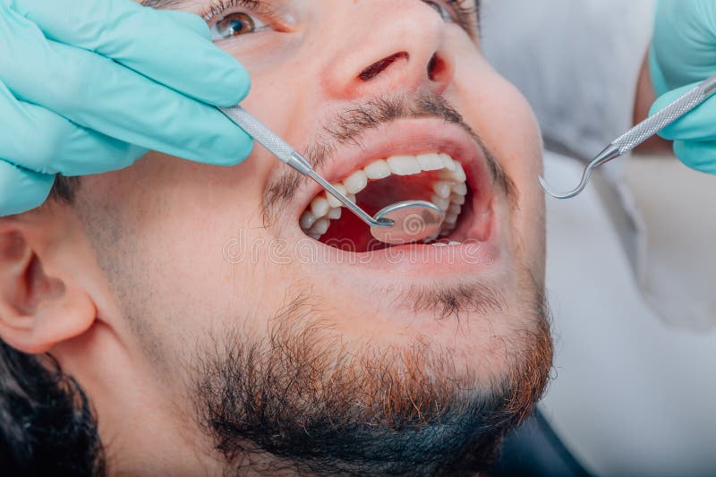 Patient mouth with dentist stock photo. Image of cleaning 274781150
