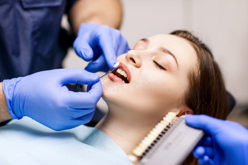 Patient`s Teeth Shade with Samples for Bleaching Treatment. Stock Image
