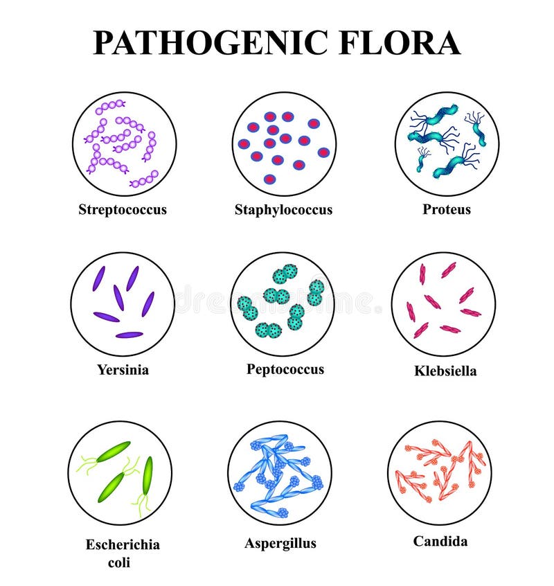 Patogen flora i inälvan kolon Infographics stock illustrationer Patogen flora i inälvan kolon Infographics stock illustrationer