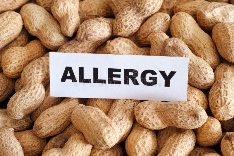 Peanut allergy