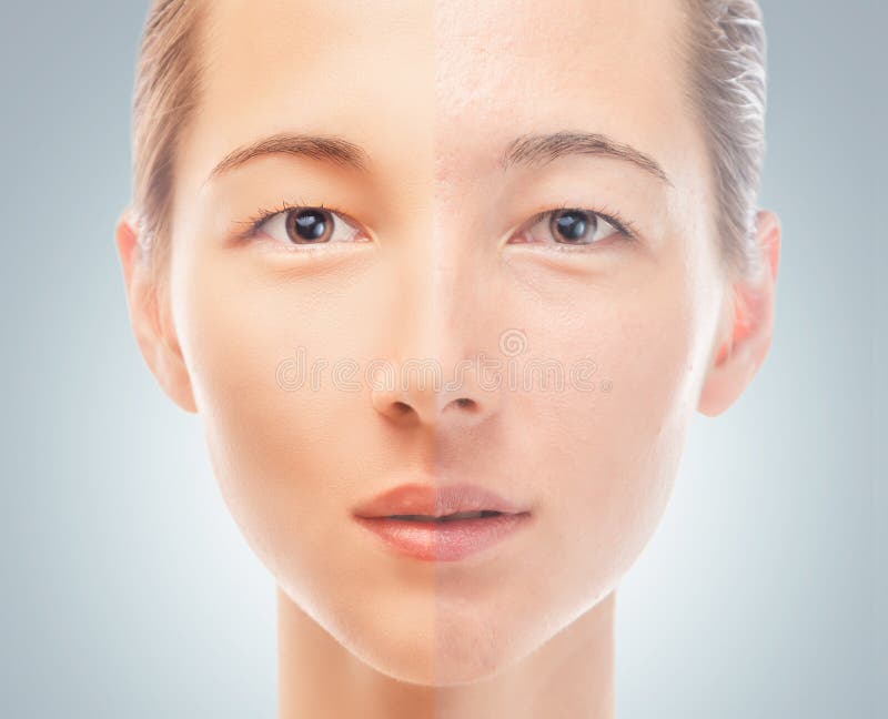 Skin of young woman before and after the cosmetics procedure, problem and smooth skin, concept of skincare. Skin of young woman before and after the cosmetics procedure, problem and smooth skin, concept of skincare