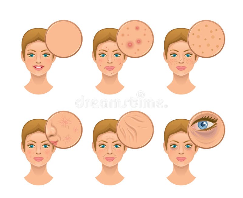 Peau de problème illustration de vecteur Peau de problème illustration de vecteur