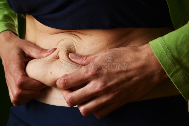 Peau excédentaire sur l'estomac d'une femme après la livraison image libre de droits Peau excédentaire sur l'estomac d'une femme après la livraison image libre de droits