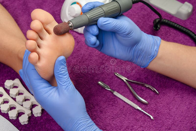 Podiatrist using grinding equipment and making procedure polish for feet  hardware pedicure. Callus peeling using professional pedicure drill  machine. Spa foot treatment. Removing hard, callused skin Stock Photo