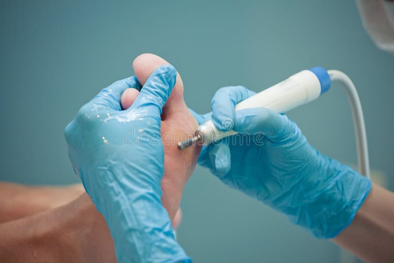 Peeling Feet Pedicure Procedure Stock Photo Image of skin, body 19662576