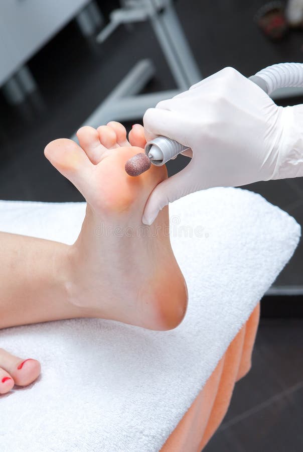 Peeling Feet Pedicure Procedure Stock Image Image of treatment