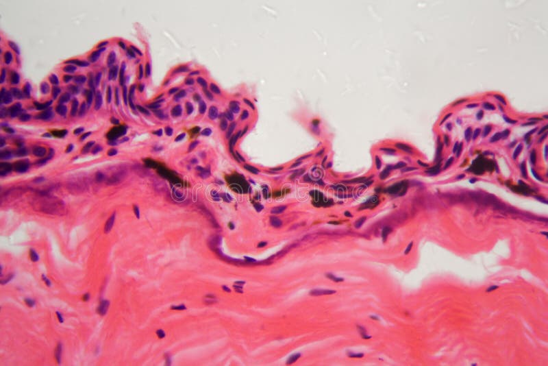 Pelle amfibia con l'ulcera sotto un microscopio