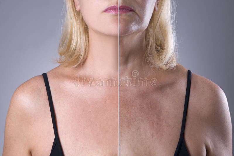 Pelle del ` s della donna di ringiovanimento, prima dopo il concetto, il trattamento della grinza, il ringiovanimento del viso e fotografia stock Pelle del ` s della donna di ringiovanimento, prima dopo il concetto, il trattamento della grinza, il ringiovanimento del viso e fotografia stock