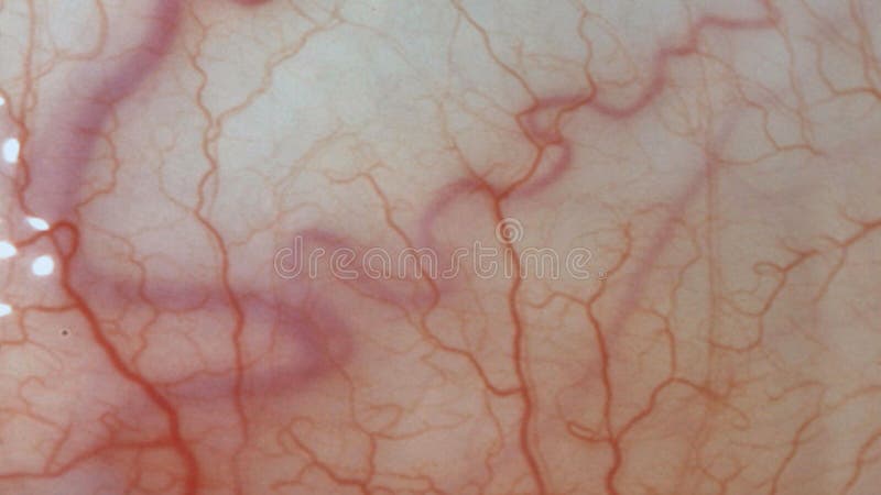 Per motivi medici Gli occhi dell'uomo rinchiudono l'immagine con le vene