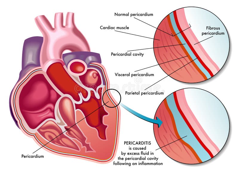 pericardial cavity