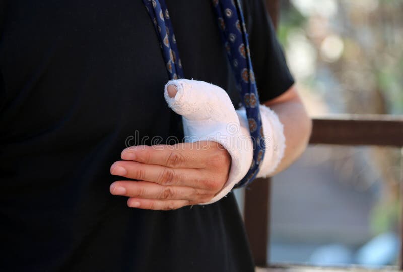 Hand in Cast on White Background Stock Photo - Image of closeup, fracture:  167244908