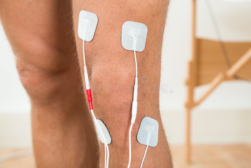 Electrodes of Tens Device on Shoulder, Tens Therapy Stock Image Image