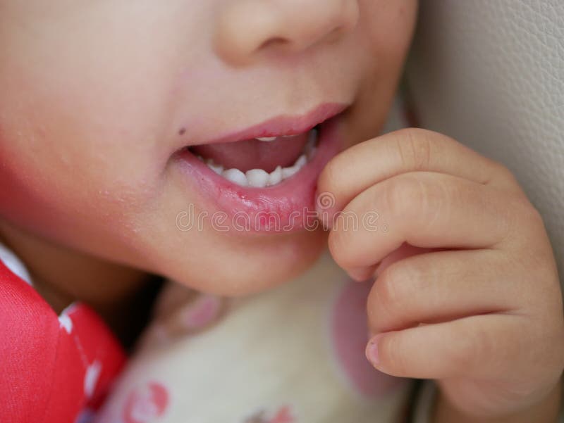 Petite Fille Qui Se Gratte Les Lèvres Sèches Et Enchaînées ...